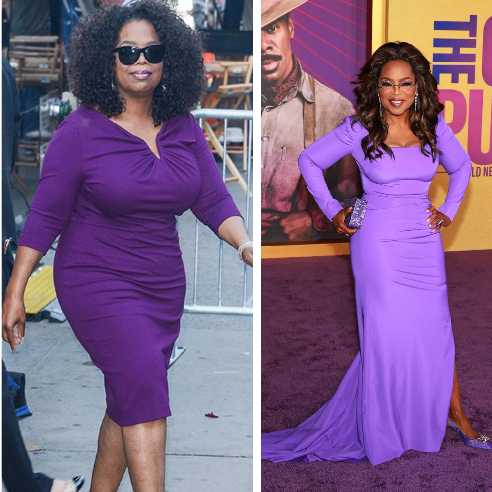 Illustrative before-and-after celebrity photo